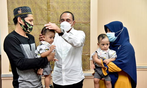 Gubernur Edy Rahmayadi Apresiasi Tim Dokter Pemisahan Kembar Siam