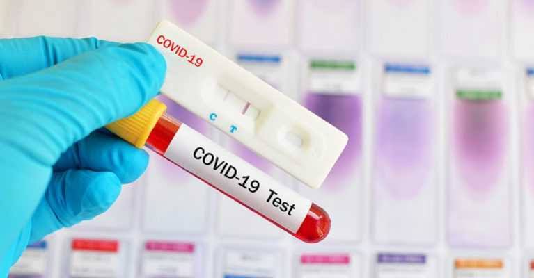 Kasus Positif Covid-19 Di DKI Bertambah 195, Pasien Sembuh Ikut Naik 113 Orang