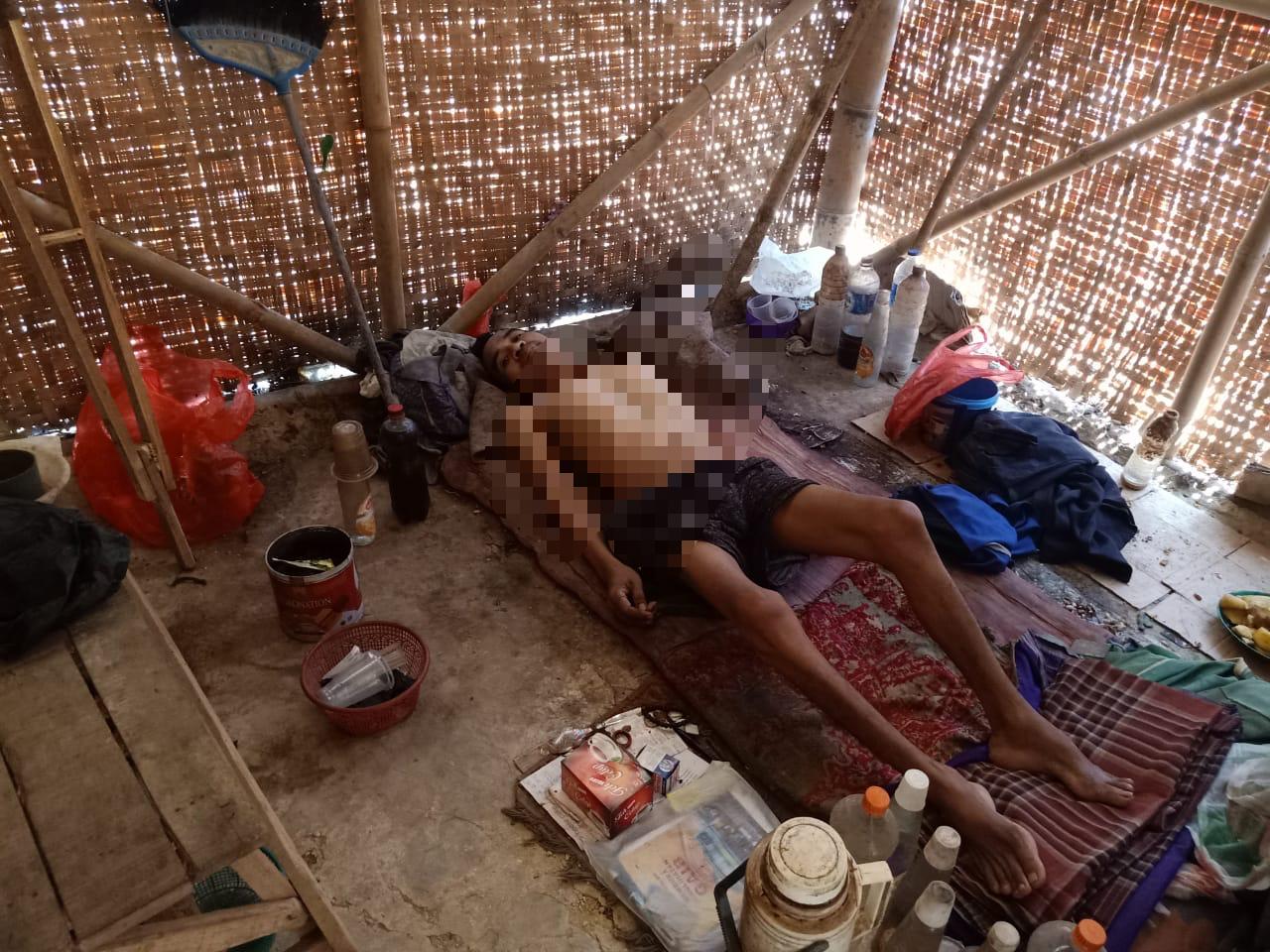 Lumpuh Menahun, Warga Cisoka Ini Belum Diperhatikan Pemkab Tangerang.
