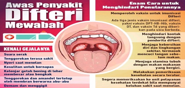 Kasus Difteri di Jakarta Meningkat Tiga Kali Lipat dibandingkan 2016